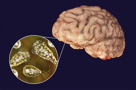  Naegleria -  Bir Şaşırtıcı Canlı: Serbest Yaşayan Bir Hücre mi Yoksa Beyinde Zararlı Bir Hastalık mı?