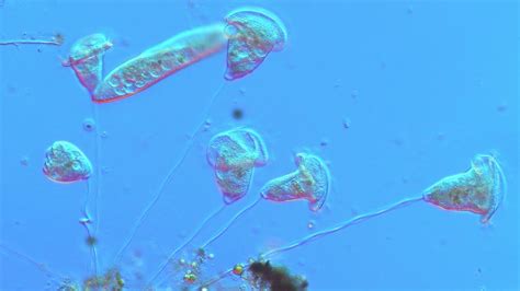  Vibrant Vorticella: Dive into the Microscopic World of these Wonderful Waterwheel-Dancing Ciliates!